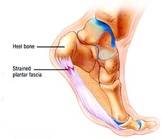 plantar fascia