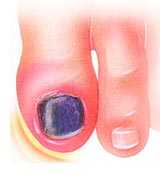 black and blue nails