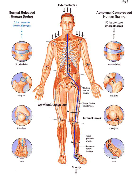 Body Alignment and Biomechanics - When Orthotics are Needed