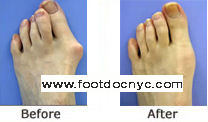 NYC Podiatry Center of Excellence