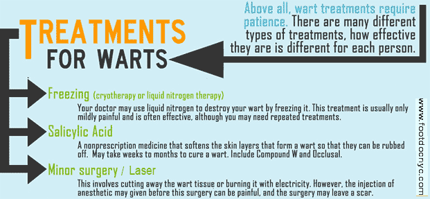 Plantar - Foot Warts Removal Treatment